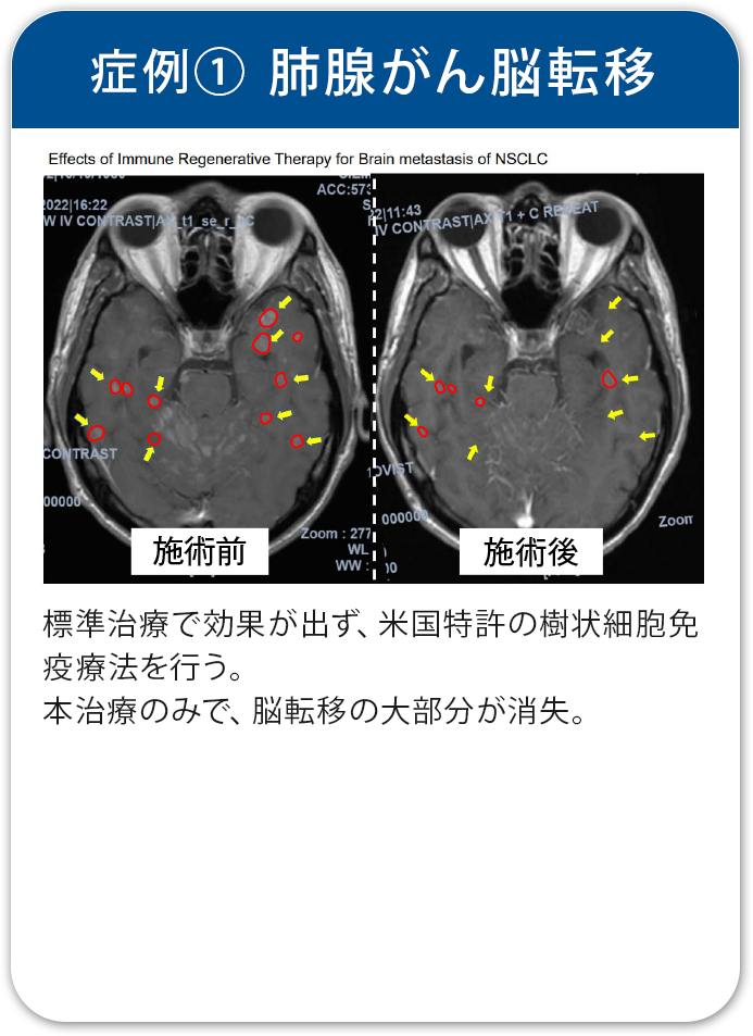 治療実績1
