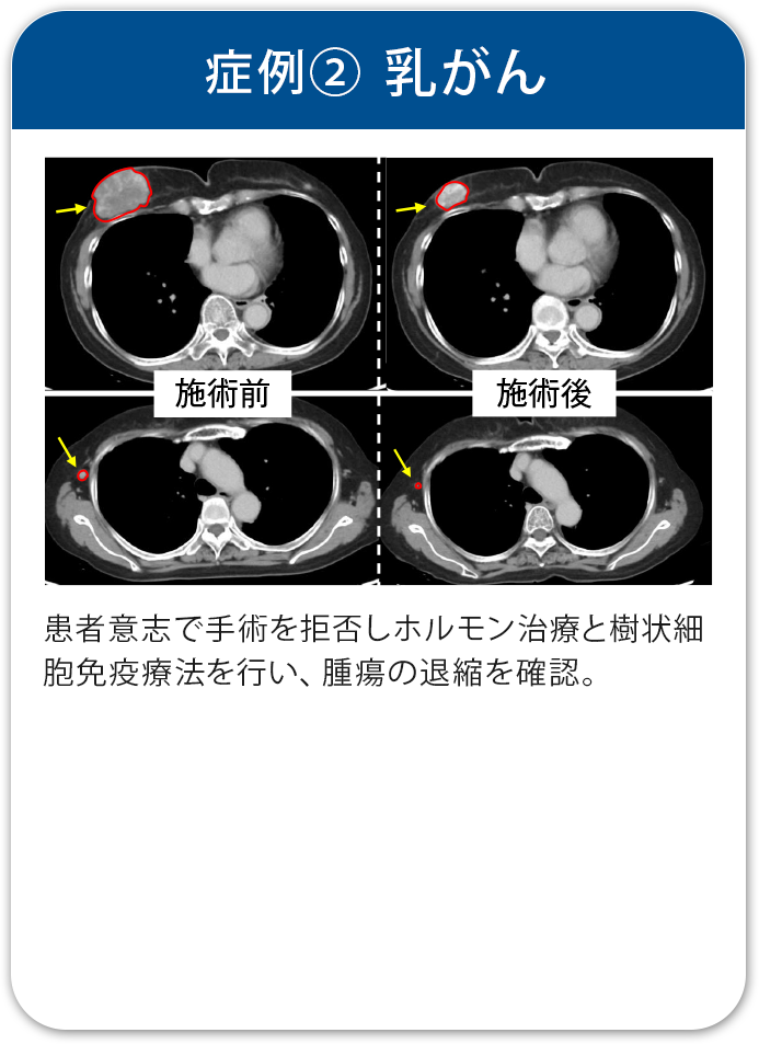治療実績2