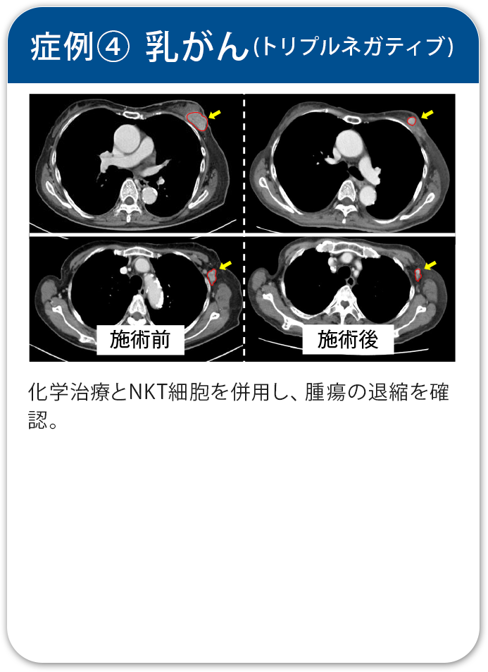 治療実績4
